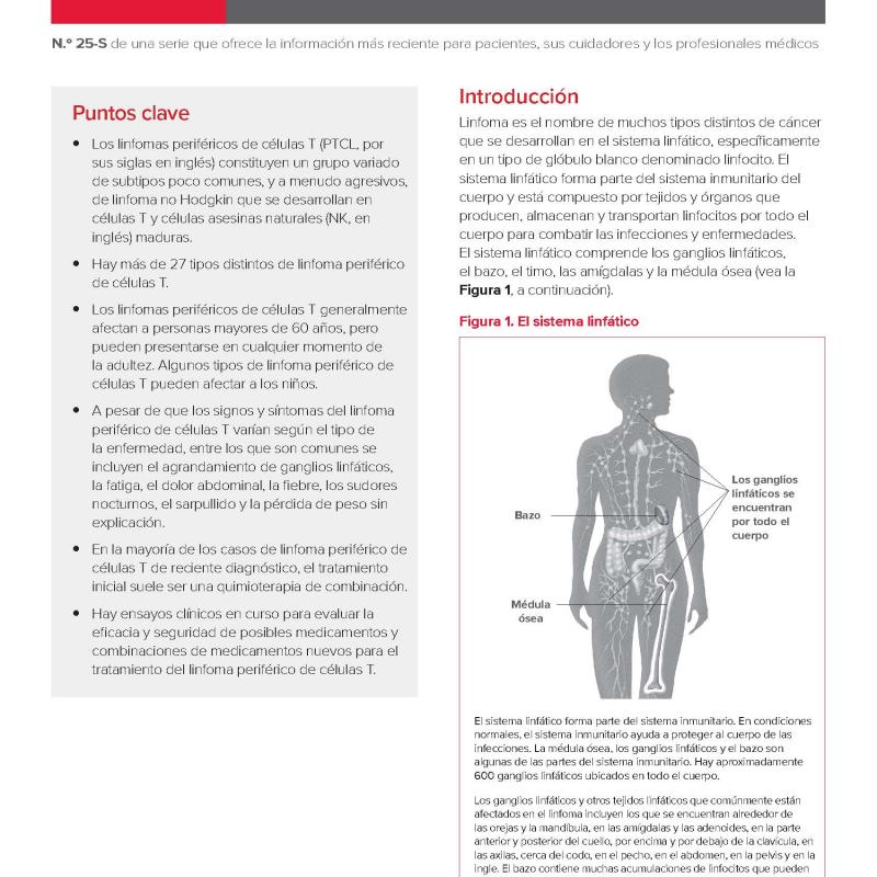 Linfoma periférico de células T