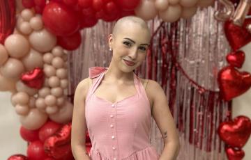 Valerie with a shaved head standing in front of balloons