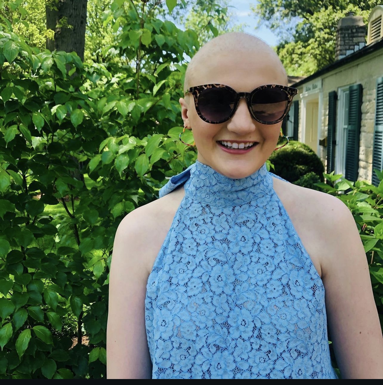 Bald white young lady wearing sunglasses and a blue top