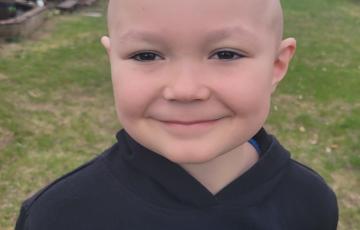 acute lymphoblastic leukemia (B-ALL)